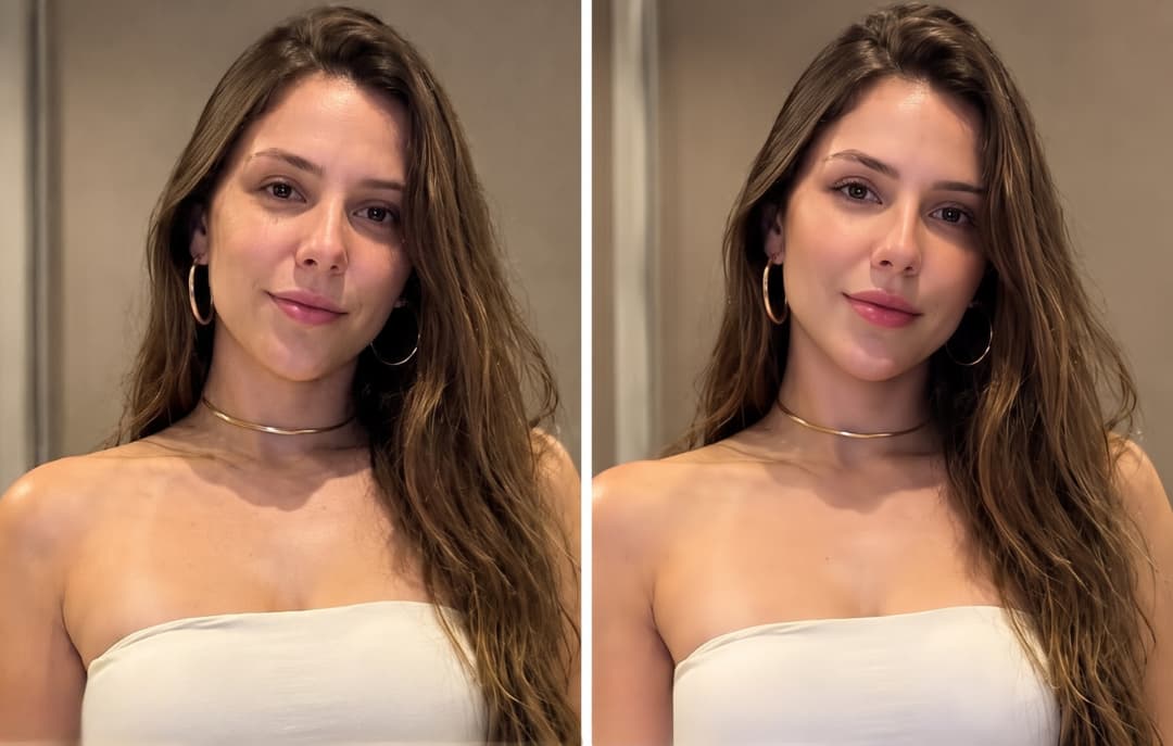 Harmonização Facial Full Face